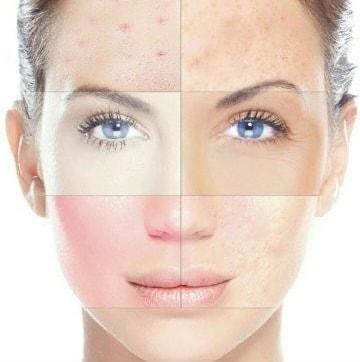 ¡NOVEDAD! Tratamiento retinopur 30% ácid&mldr;