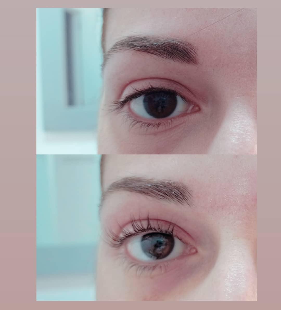 Cambia tu mirada de forma natural con el&mldr;