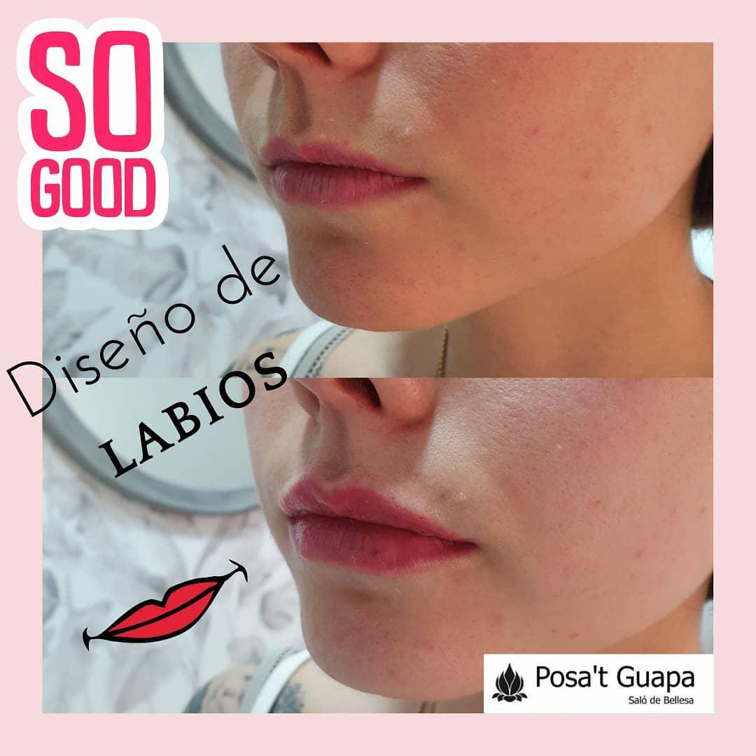 El antes y después de algunos diseños de&mldr;