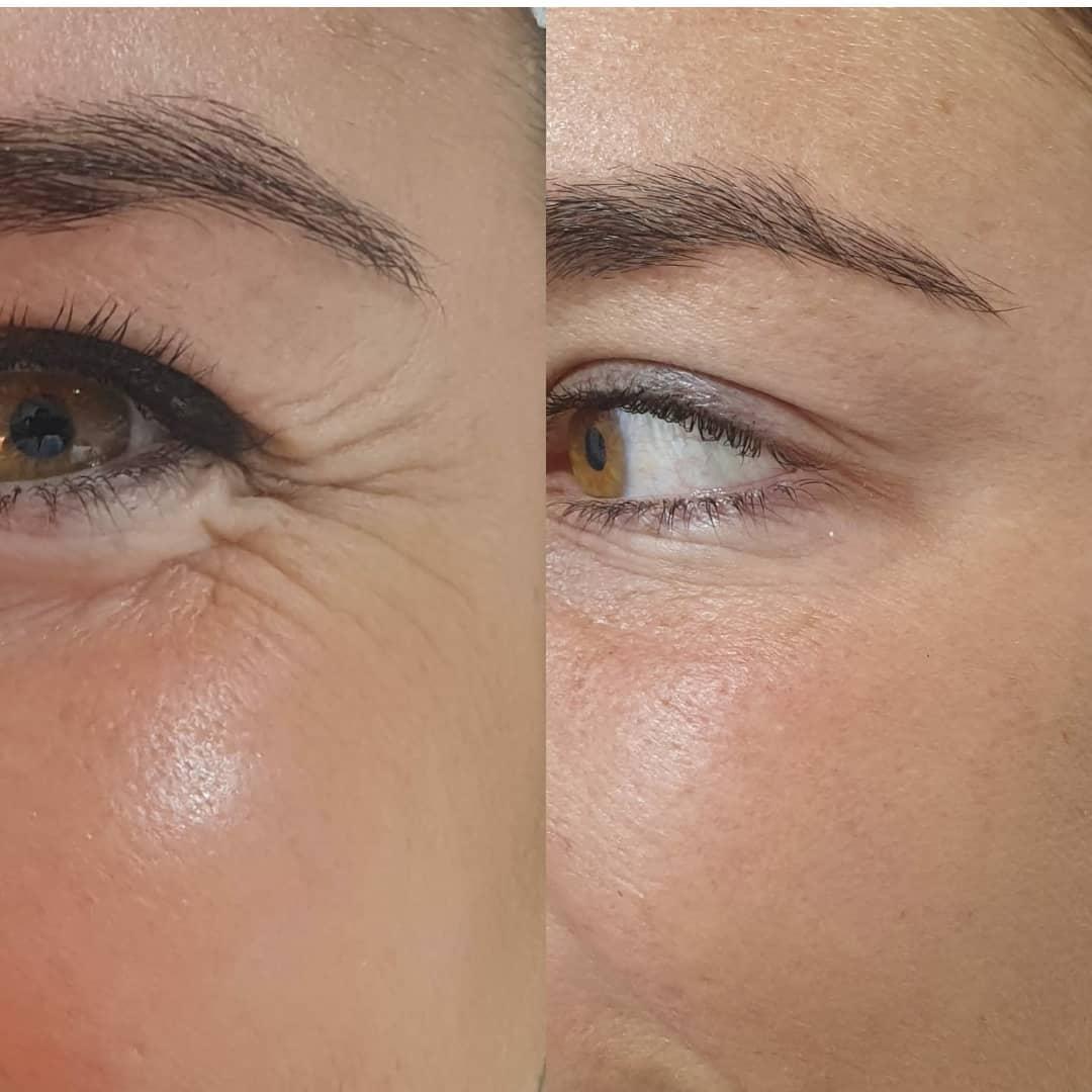 Una de las zonas en donde notamos las pr…